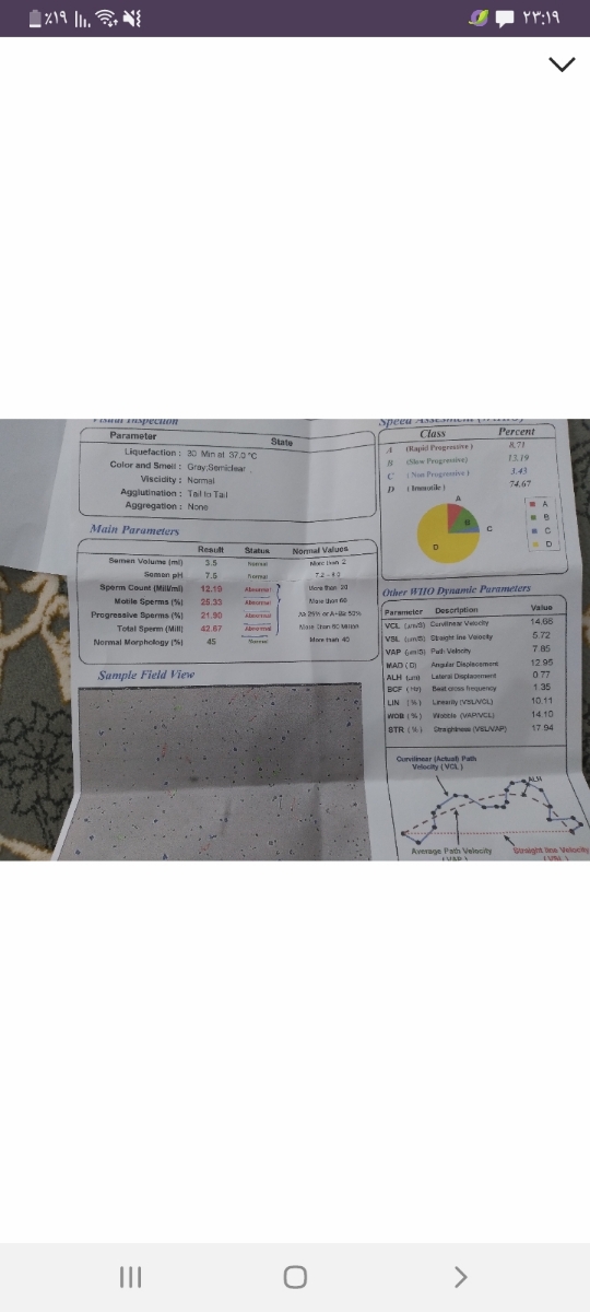 آیا کسایی ک واریکوسل دارند