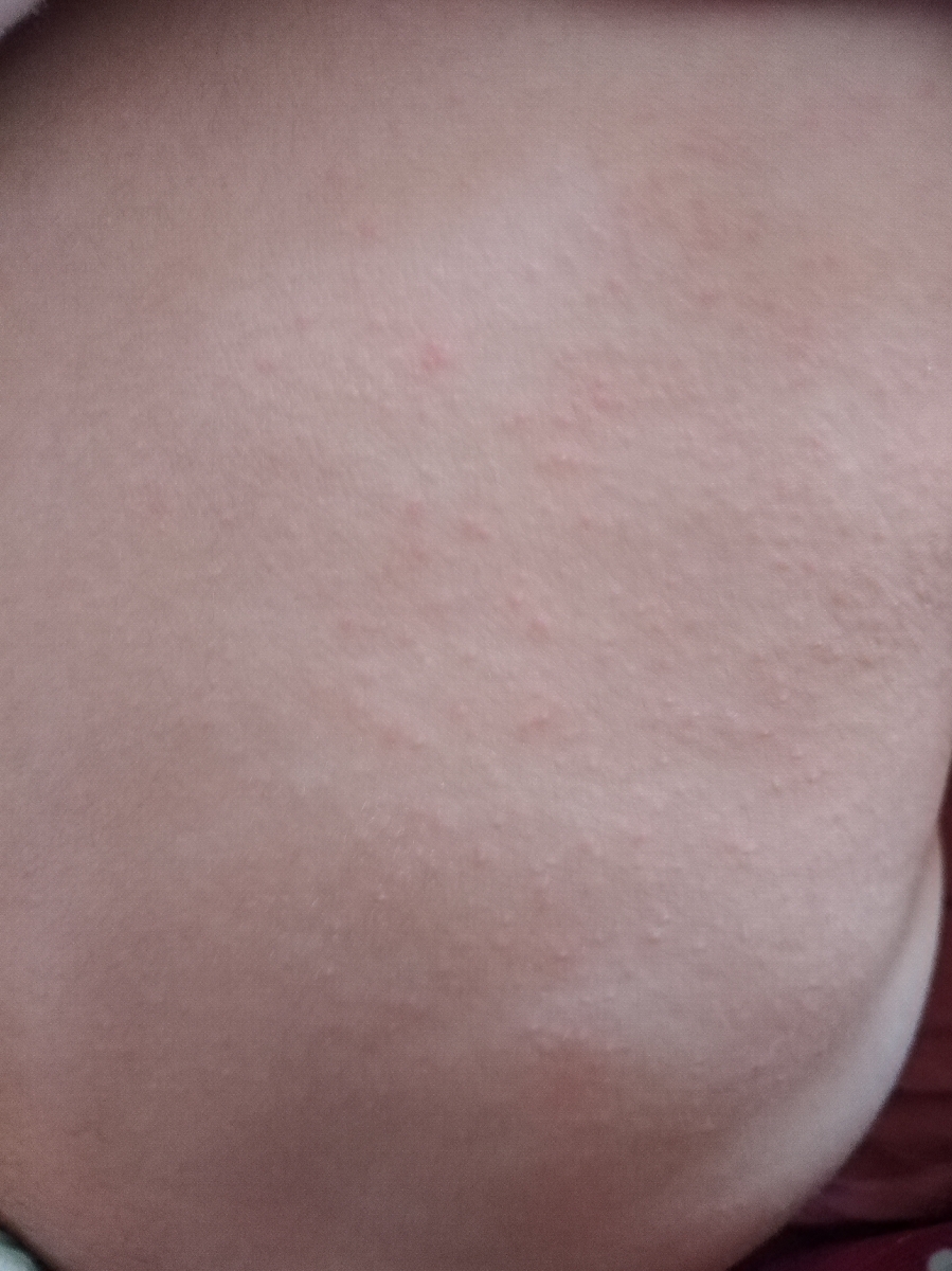 سمت چپ کمرش هم بود اونا رفته زده راستش حالا