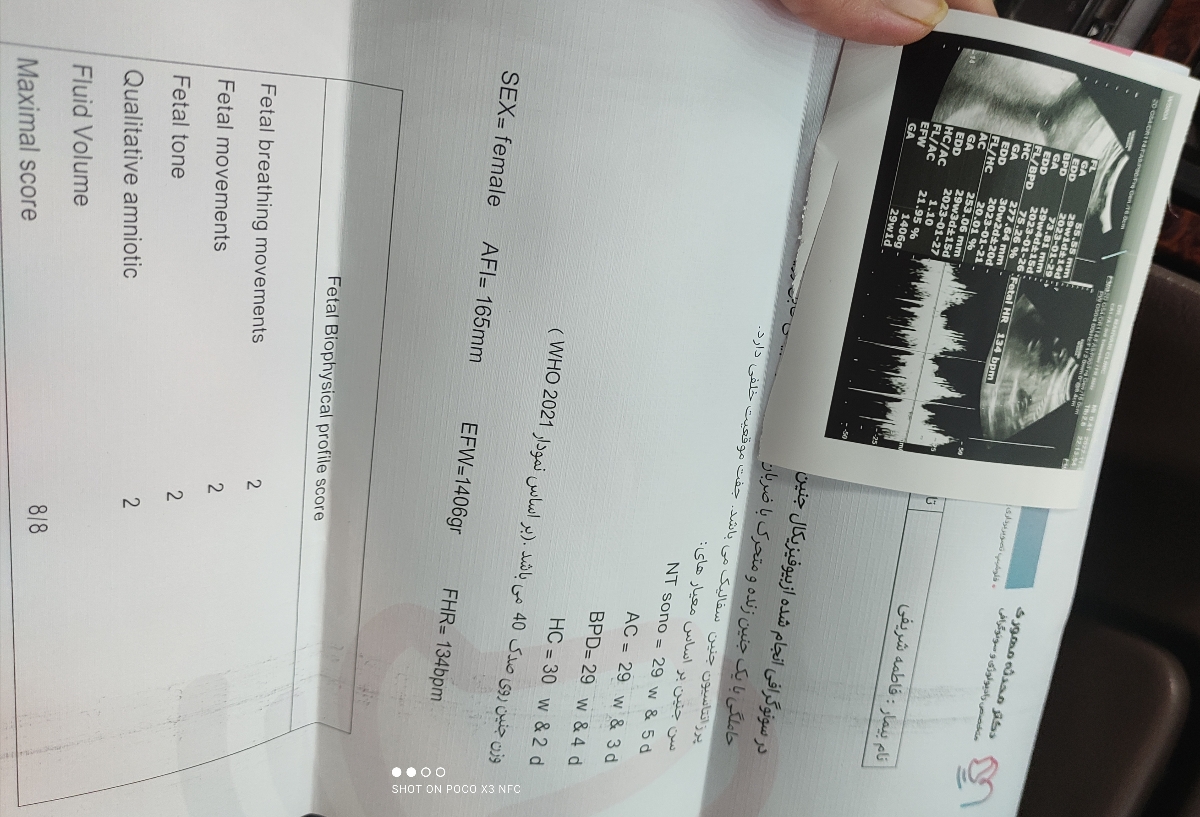 سونو گرافی ۲۹ هفته