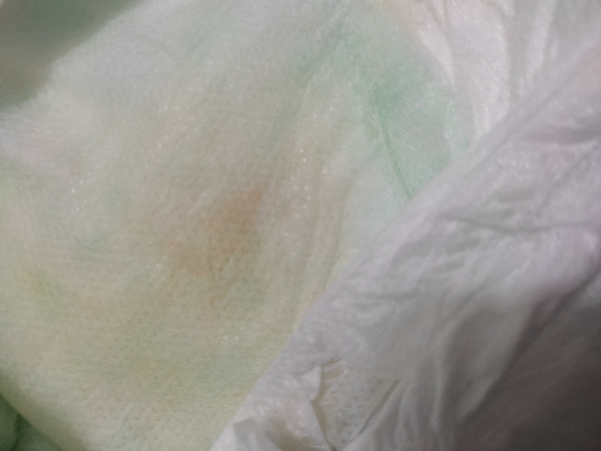 نوزادم دو ماهشه ادرار مدفوع کم شده