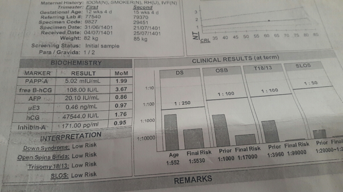 غربالگری دوم