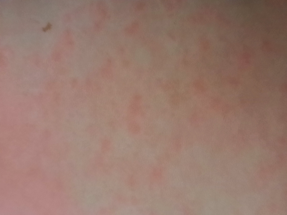 بدن دختر من