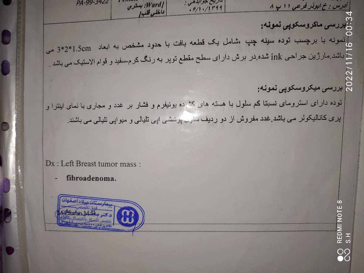 این نمونه آخری توده ای که در آوردم 