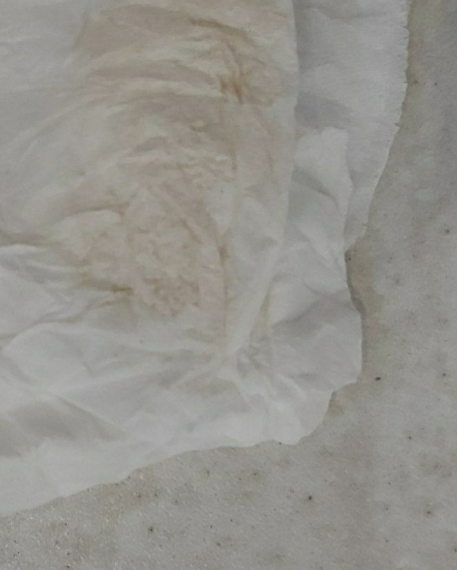 تشکیل قلب جنین ولک بینی مختصر