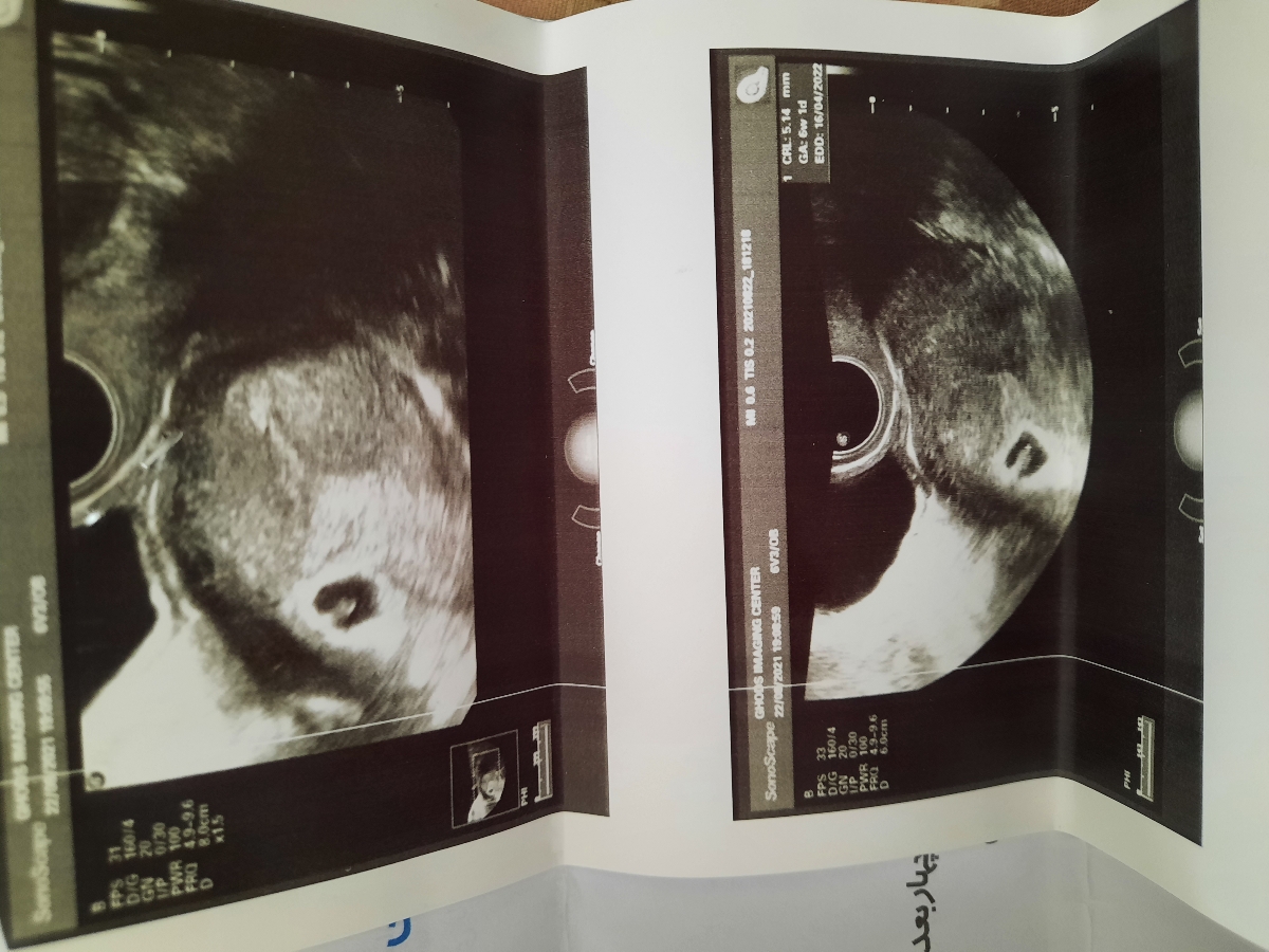 این عکس سونوگرافی 