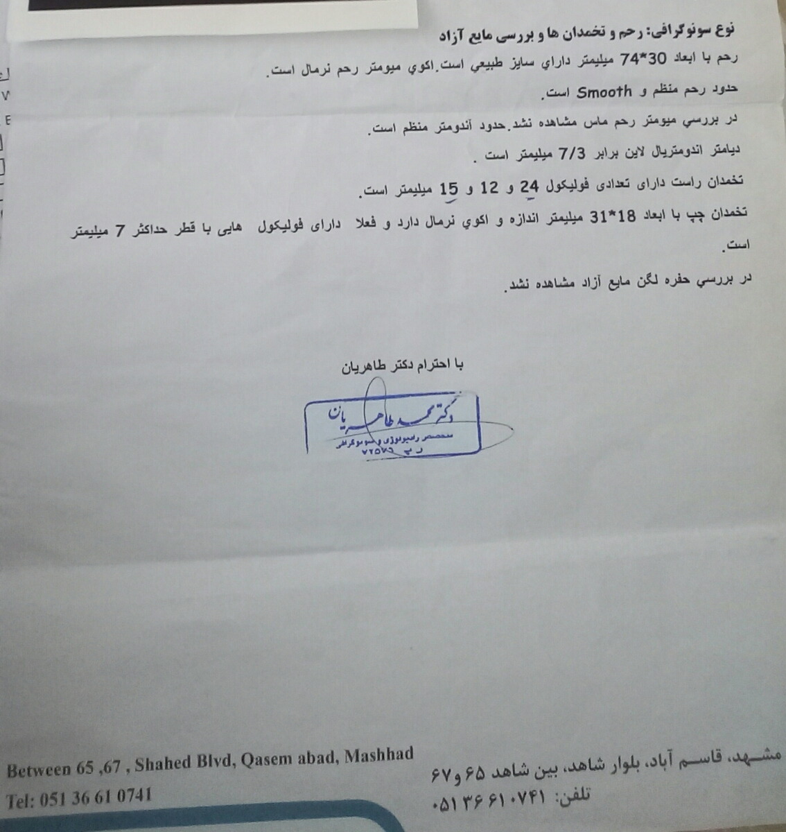 سونو روز تخمک گذاری خودم 