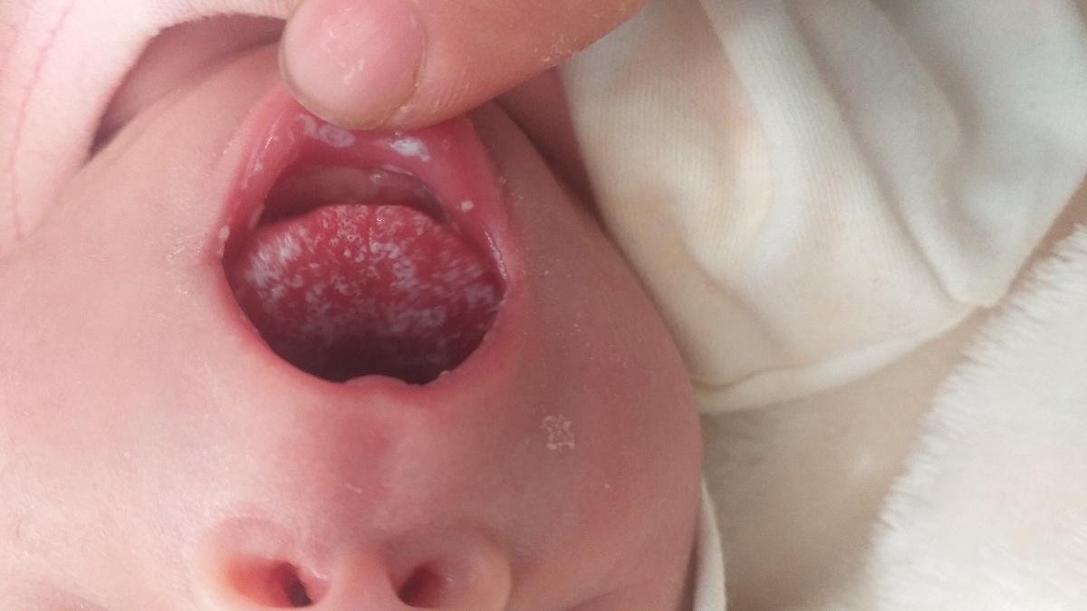 برفک یا رد شیر خشک برفک یا رد شیر خشک