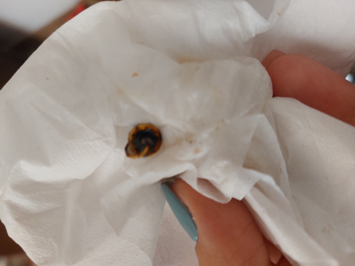 پیدا کردن جسم در مخاط بینی دخترم