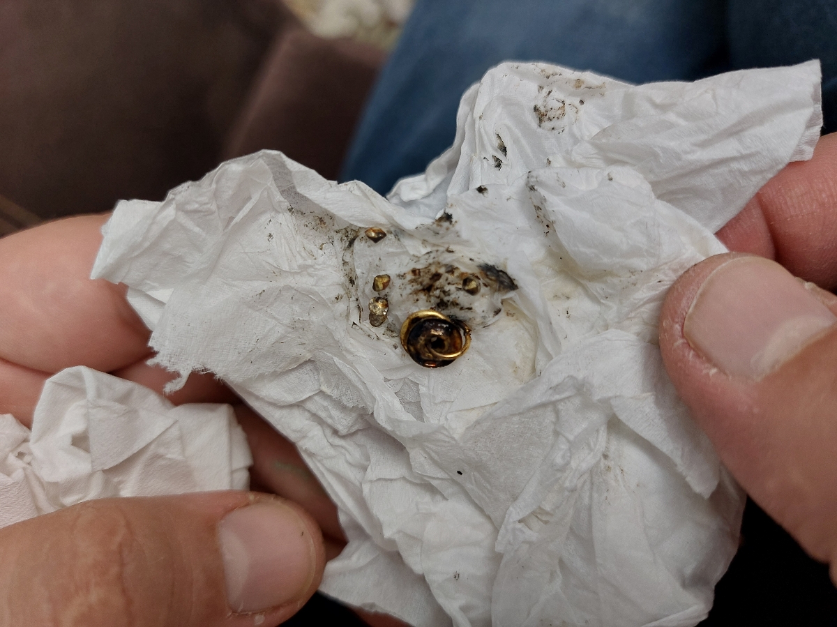 پیدا کردن جسم در مخاط بینی دخترم