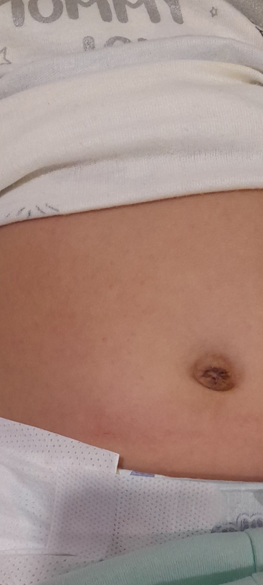 سلام دکتراومادکتربه پسرم هیستازدداده