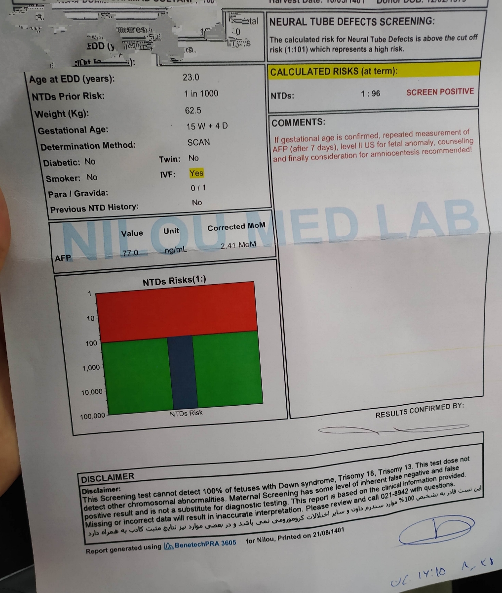 اینم ازمایشم اینم ازمایشم