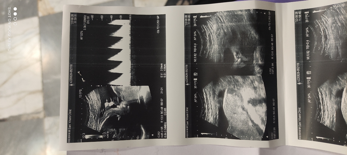 تفسیر سونوگرافی و NST
