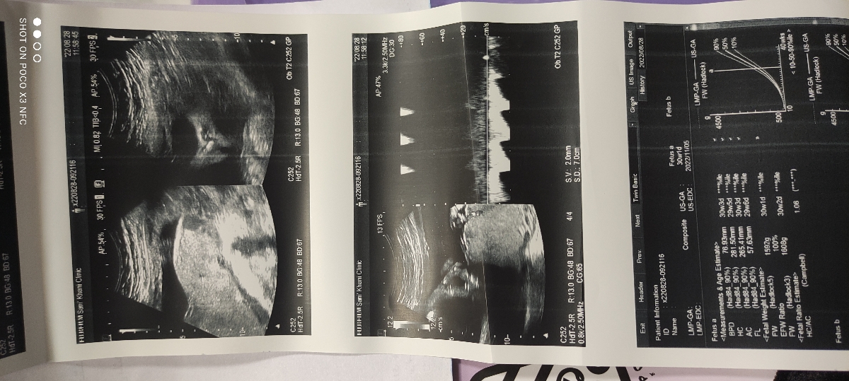 تفسیر سونوگرافی و NST