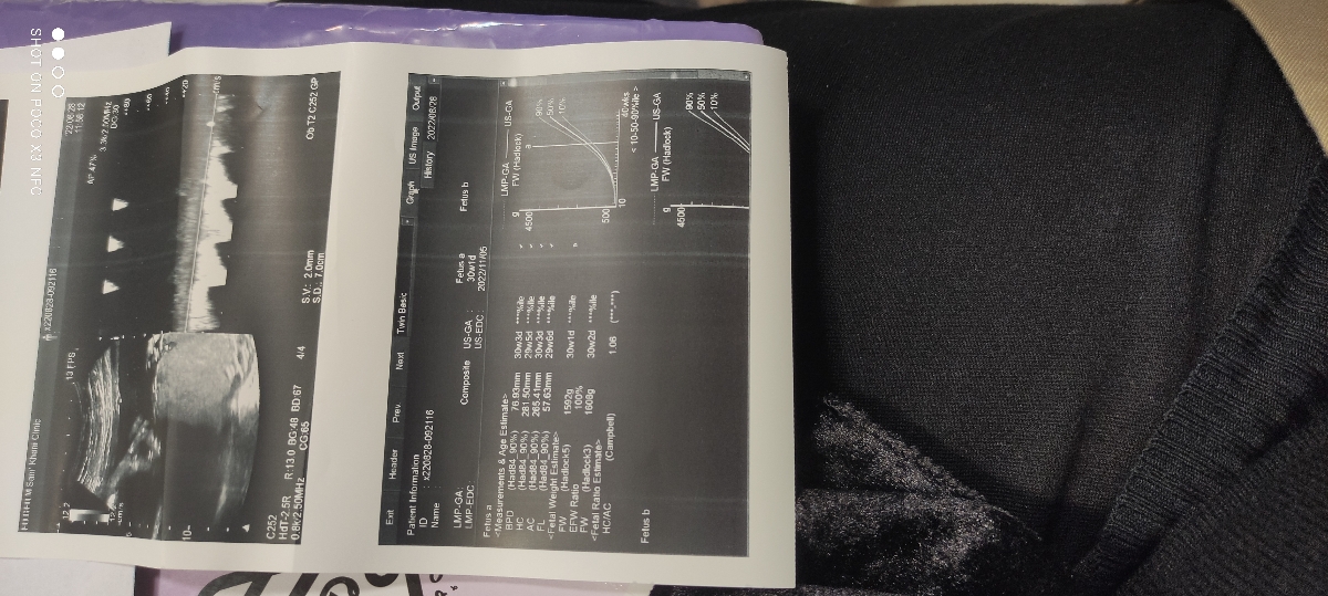 تفسیر سونوگرافی و NST
