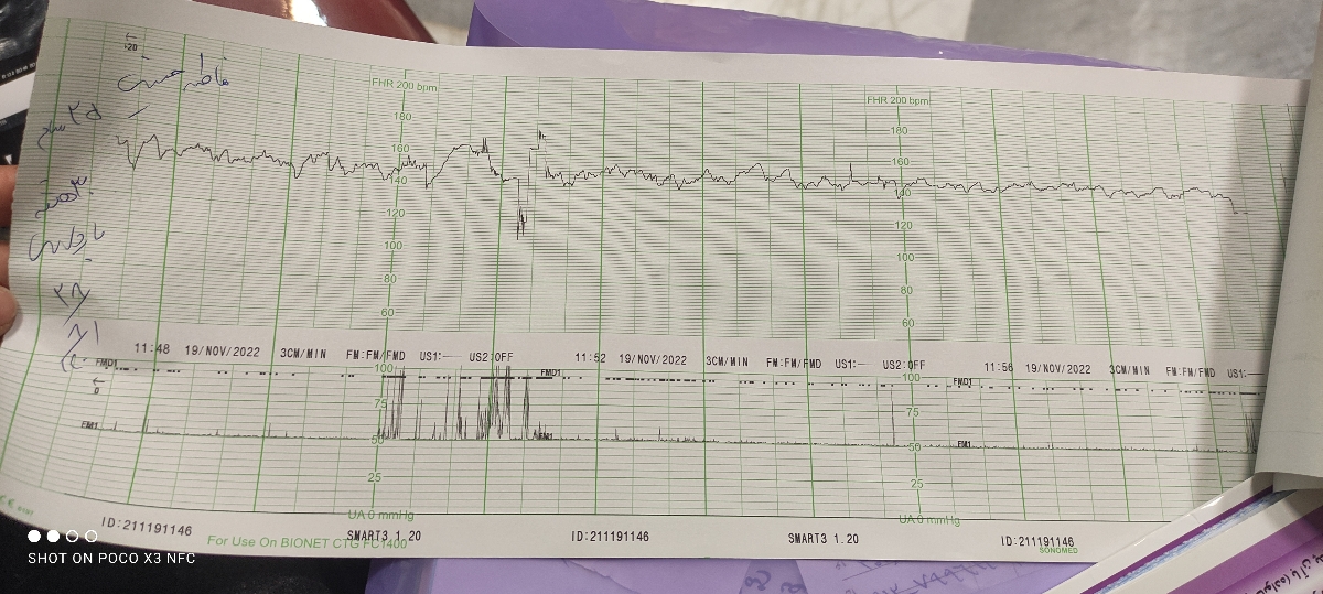 تفسیر سونوگرافی و NST