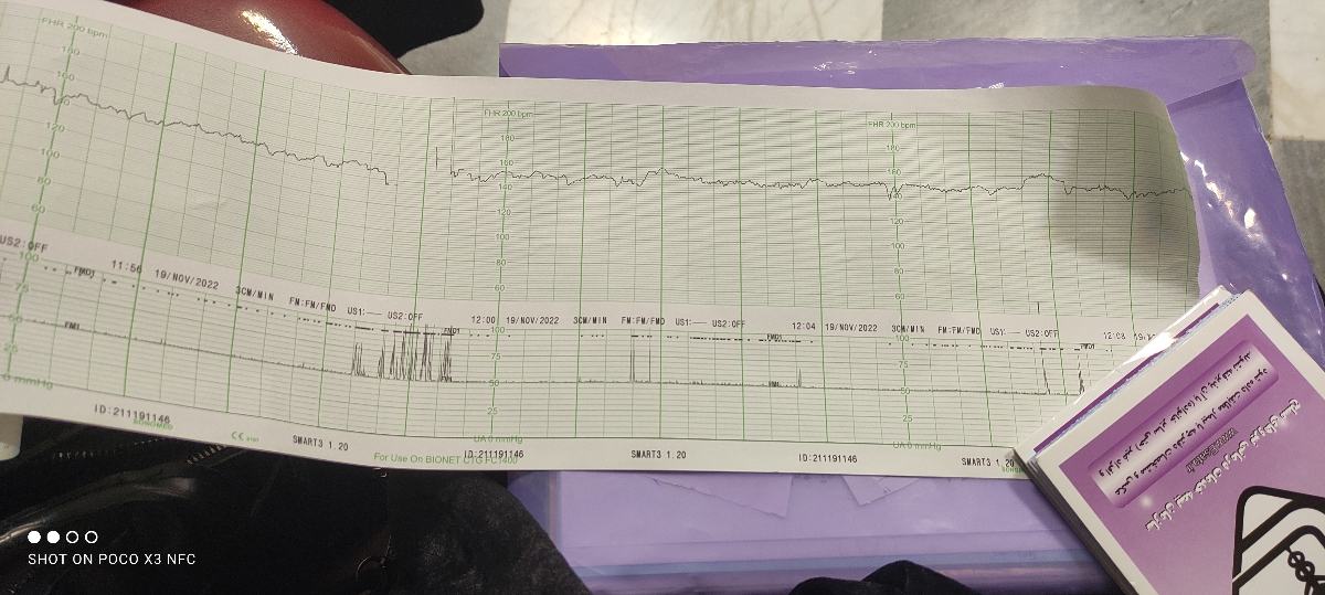 تفسیر سونوگرافی و NST