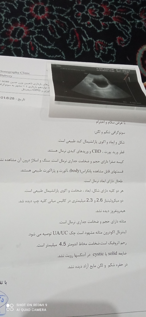 انجام سونوگرافی شکم ولگن انجام سونوگرافی شکم ولگن