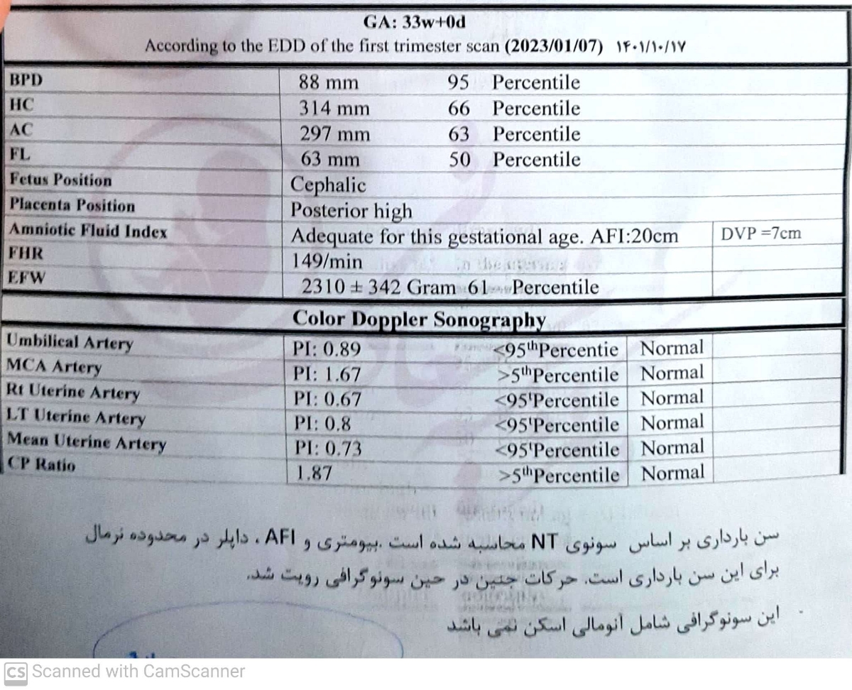 تفسیر سونوی داپلر وزن