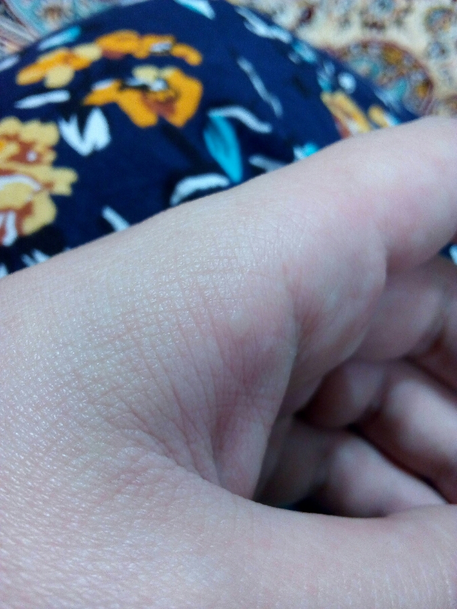 این رو دستم چی میتونه باشه شبیه تاوله ولی دردی نداره نگران شدم اگ خدایی نکرده یک درصد هم زگیل داشته باشم با تماس دست با جایی ک زگیل داره میتونه سرایت کنه من خیلی استرسی هستم همش فکر میکنم زگیل دارم انقدر وسواس شدم بعد سرویس دوسه بار بدنم با صابون میشورم دستمم دوبار مایع میزنم حس میکنم تمیز نمیشه این رو دستم چی میتونه باشه شبیه تاوله ولی دردی نداره نگران شدم اگ خدایی نکرده یک درصد هم زگیل داشته باشم با تماس دست با جایی ک زگیل داره میتونه سرایت کنه من خیلی استرسی هستم همش فکر میکنم زگیل دارم انقدر وسواس شدم بعد سرویس دوسه بار بدنم با صابون میشورم دستمم دوبار مایع میزنم حس میکنم تمیز نمیشه