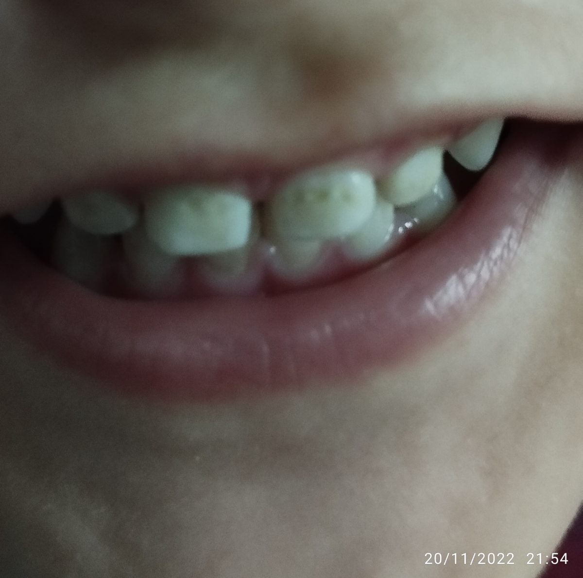 مرتب براش چه مسواک انگشتی چه مسواک ساده هم میزنم مرتب براش چه مسواک انگشتی چه مسواک ساده هم میزنم