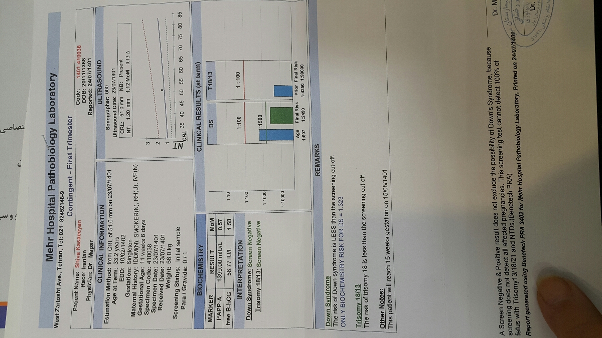 ریسک بالای سندروم داون