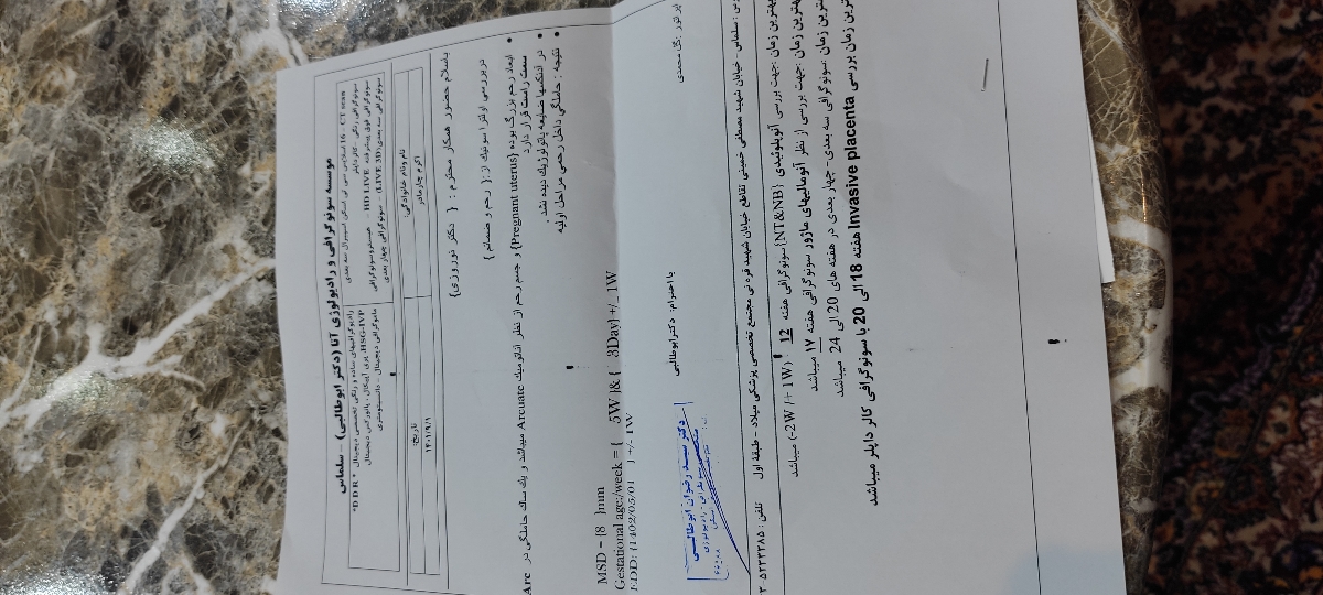 کله پاچه خوردنش مشکلی نیس