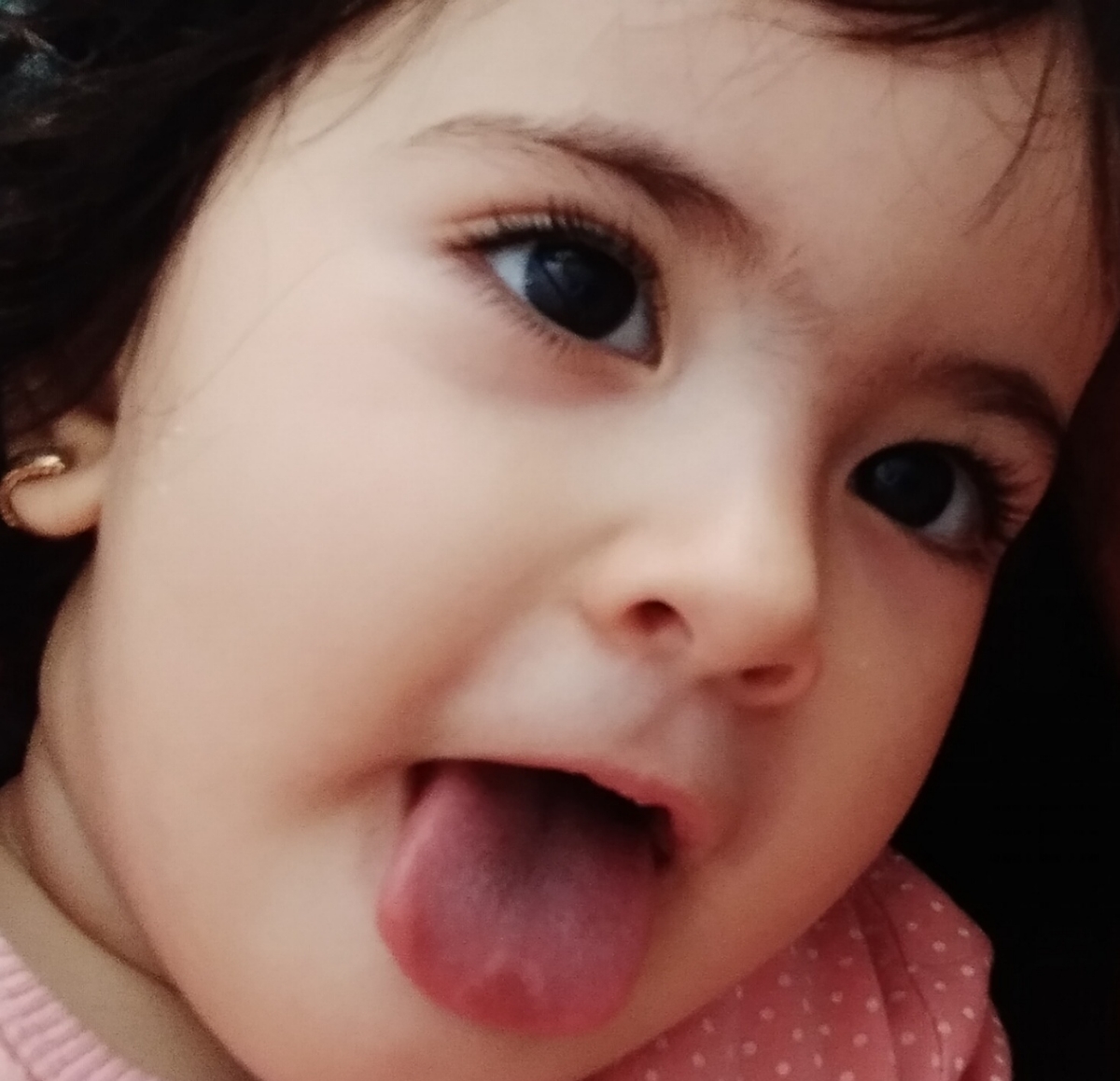 سلام دکتر جان و دوستان اومایی ،چند روزه رو زبون حلما یه دایره قرمز شده!!
