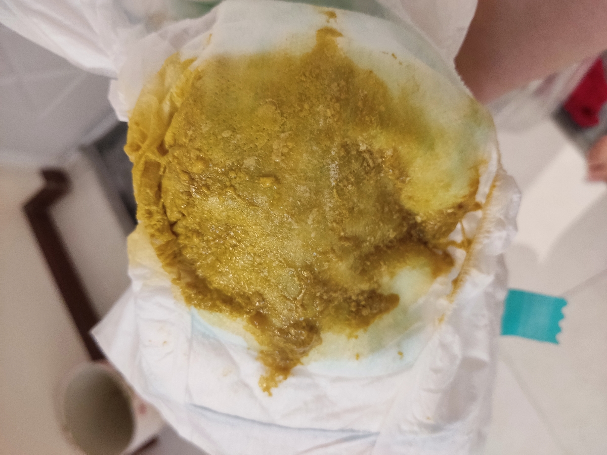 سلام .لطفا راهنماییم کنید بچم اسهاله و خوب نمیشهه خیلی نگزانم+عکس