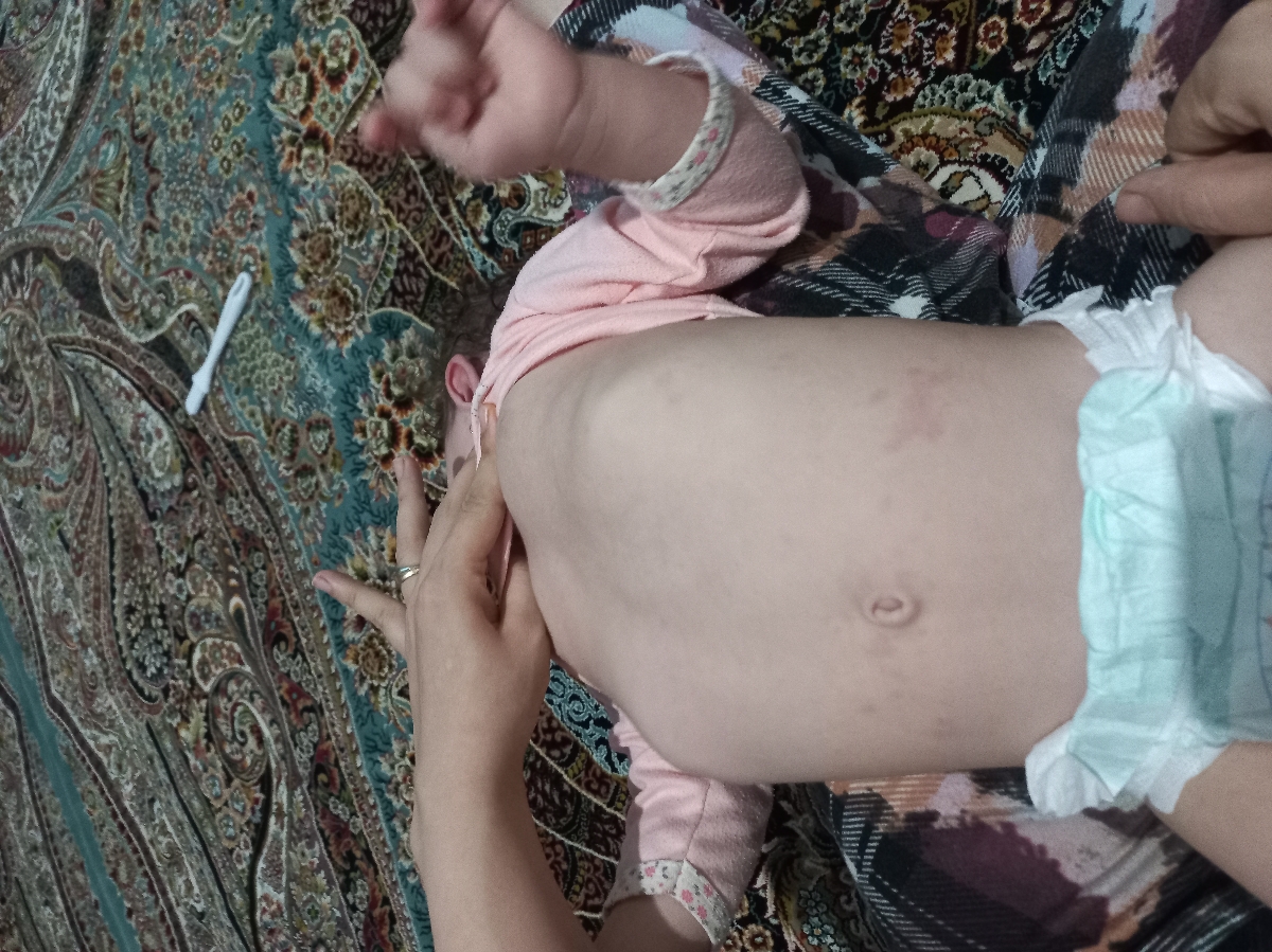 دخترم بدن و صورتش جوش داره کسی تجربه داره؟