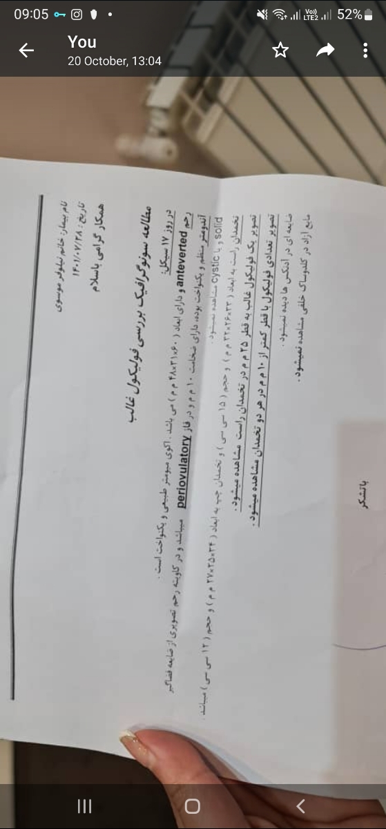 آزاد نشدن فولیکول با وجود آمپول hcg آزاد نشدن فولیکول با وجود آمپول hcg