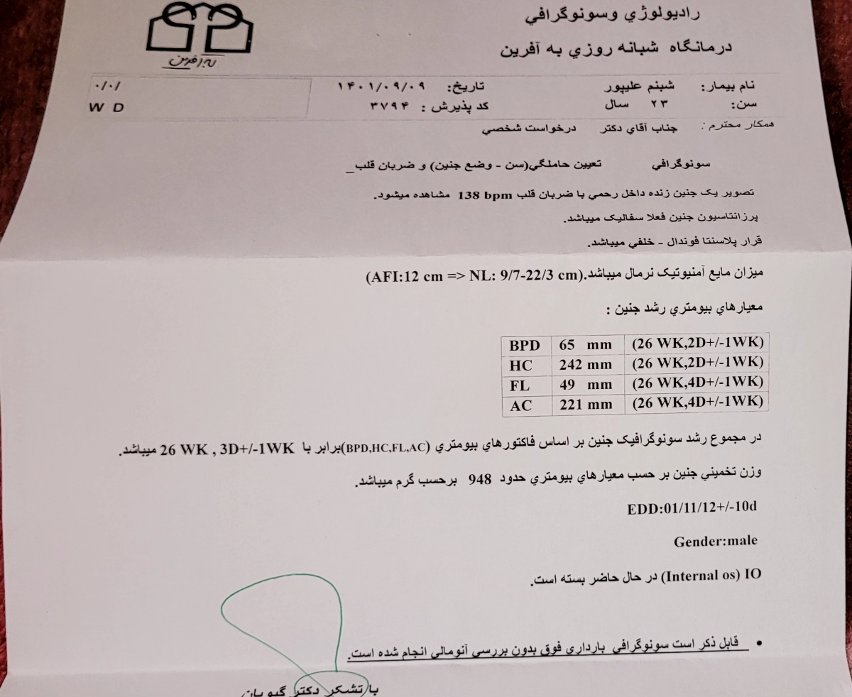 این آخرین سونو بود ک گف مایع بچه خوبه این آخرین سونو بود ک گف مایع بچه خوبه