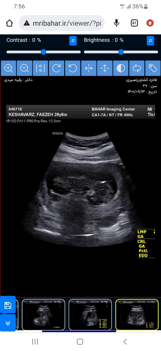 مامانای ۱۰ هفته بیاین آشنا بشیم باهم مامانای ۱۰ هفته بیاین آشنا بشیم باهم