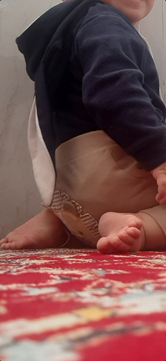 پای راستشو کلا کج میکنه هم موقع نشستن هم موقعی که دستشو میگیرم ایستاده باشه یا وقتی تو روروئک میزارمش پای راستشو کلا کج میکنه هم موقع نشستن هم موقعی که دستشو میگیرم ایستاده باشه یا وقتی تو روروئک میزارمش