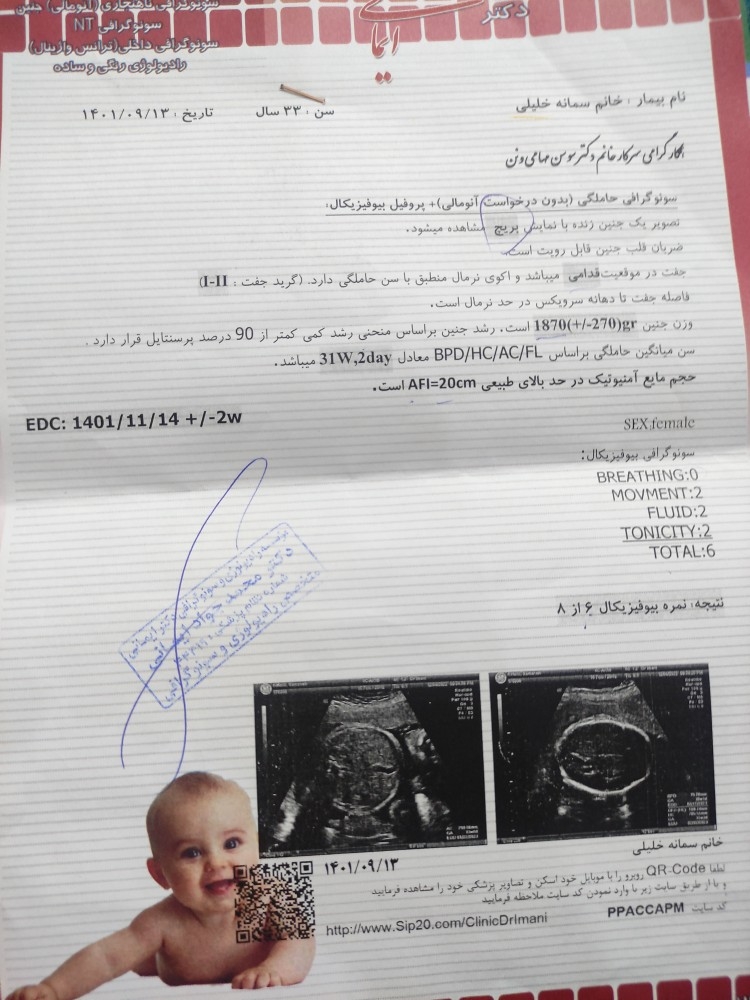 قند بالا در حاملگی