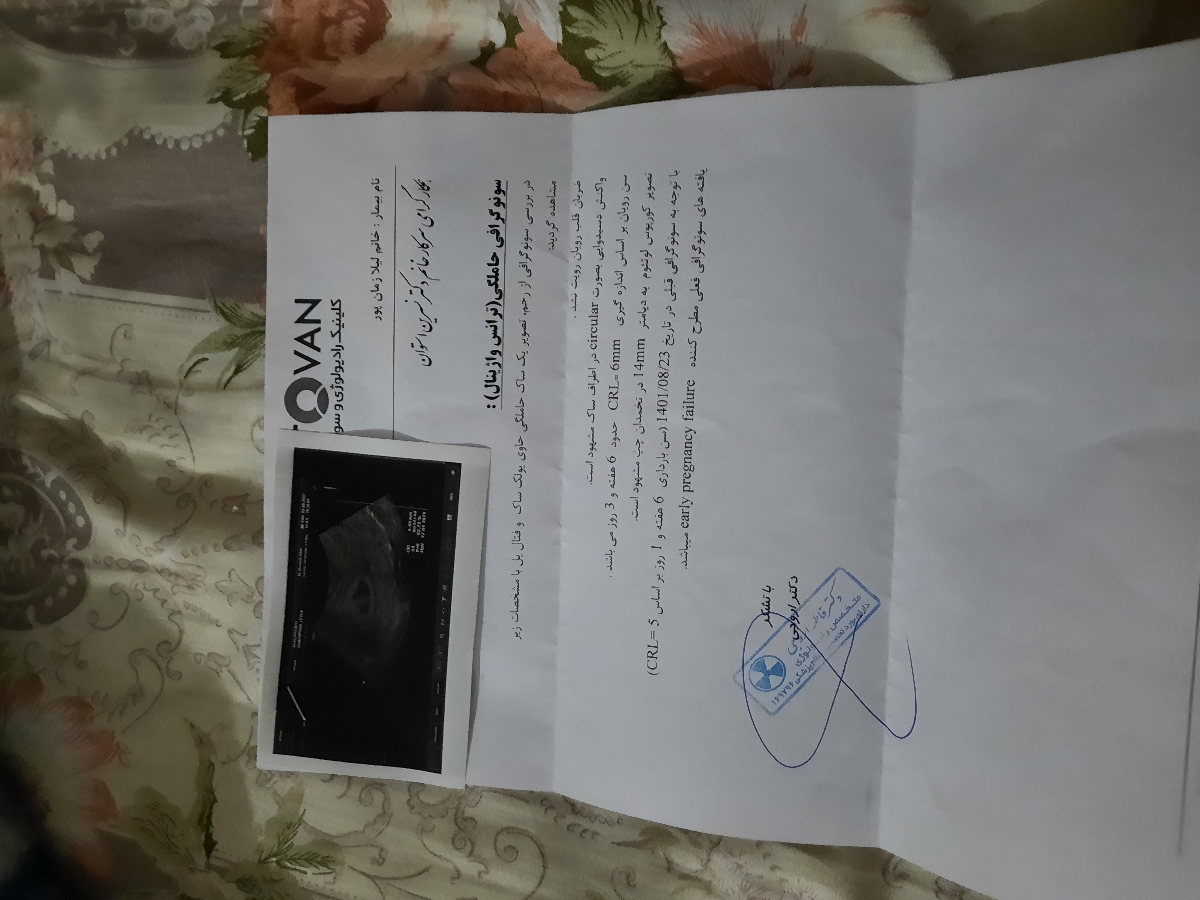 این عکس سونوگرافی ۶آذر ماه بود این عکس سونوگرافی ۶آذر ماه بود