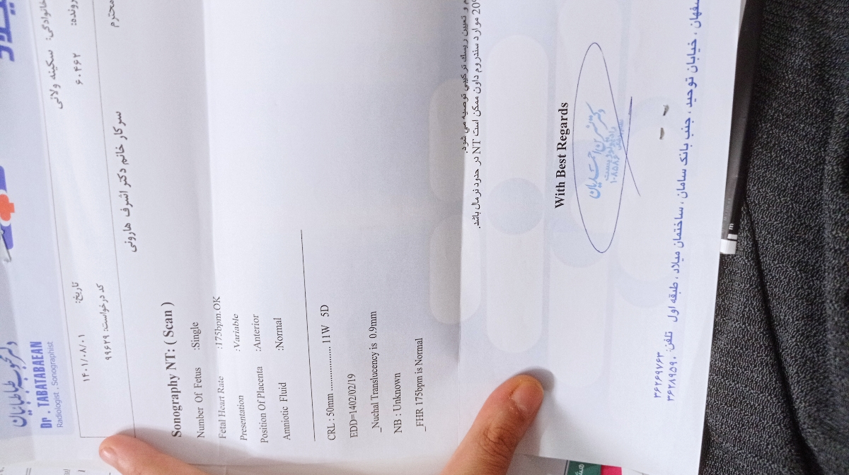 سونو ان تی سونو ان تی