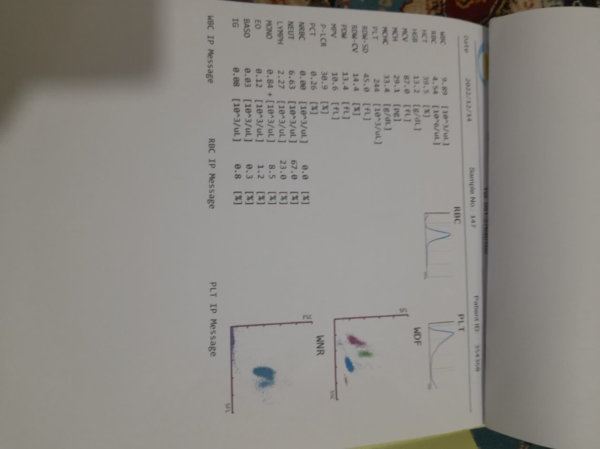 لطفا تفسیر آزمایش خواهرم لطفا تفسیر آزمایش خواهرم
