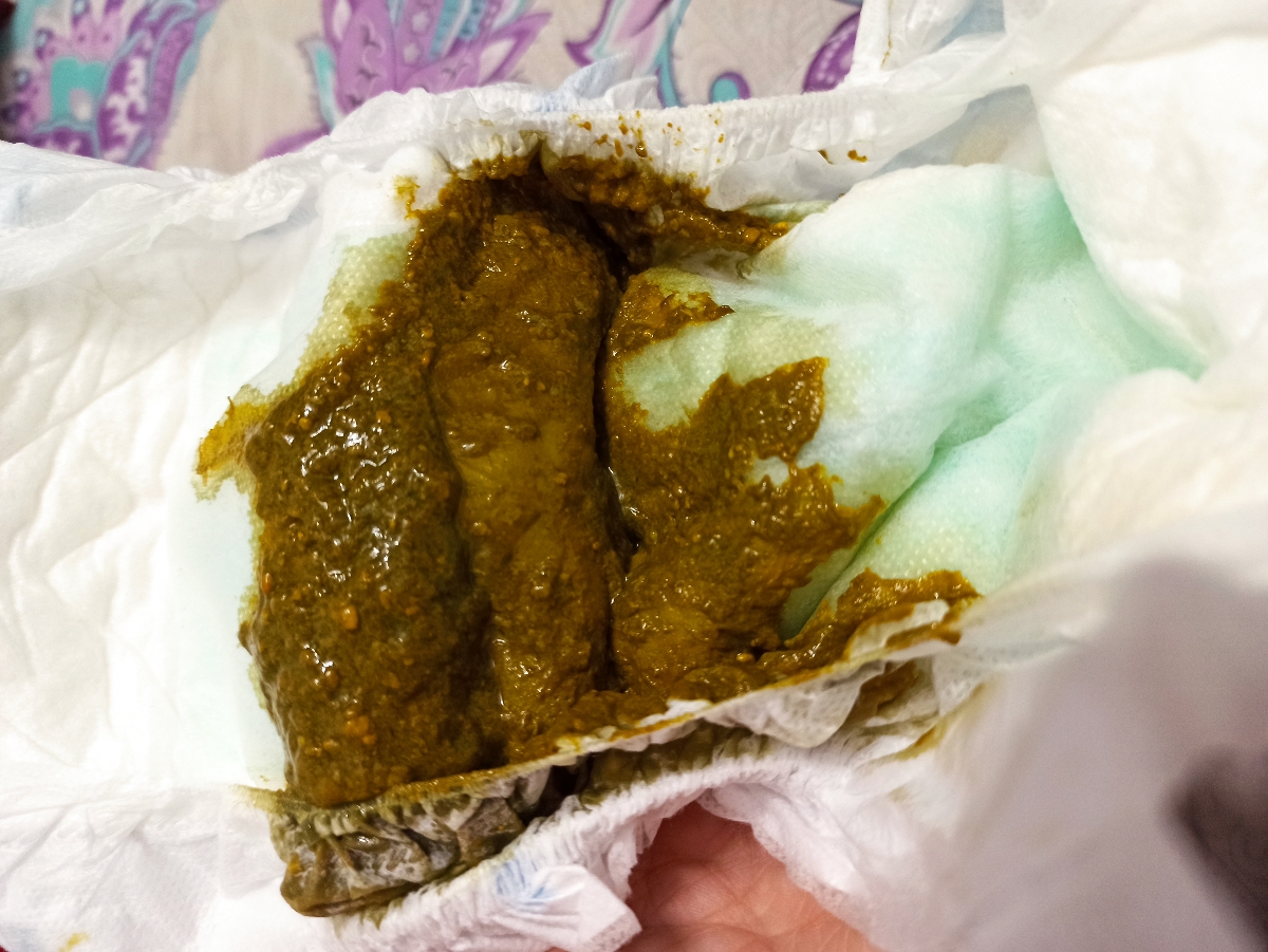 خانوم.دکتر با عرض معذرت این مدفوع پسرم هس خانوم.دکتر با عرض معذرت این مدفوع پسرم هس