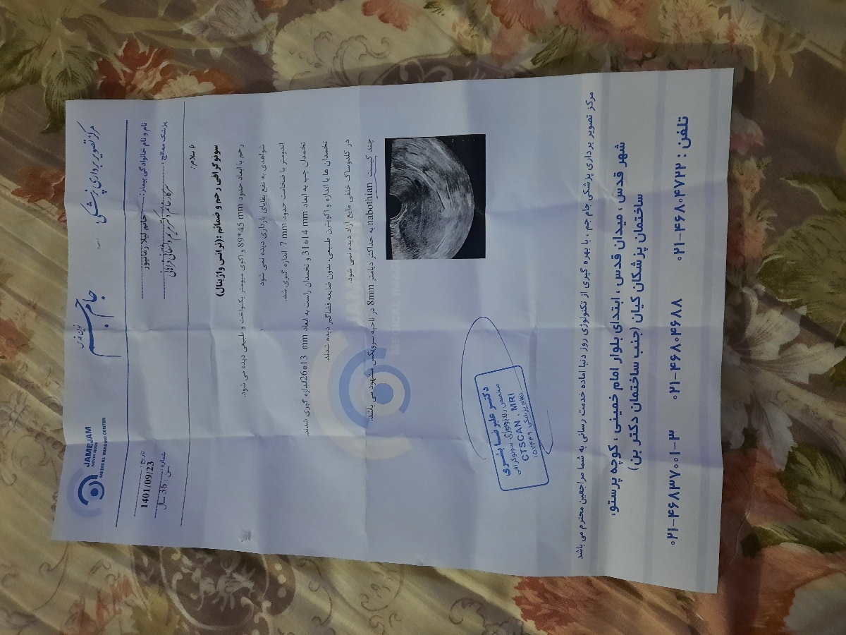 سلام خوبی خانم دکتراوماعزیز لطف میکنید جواب سونوگرافی من ببینید سلام خوبی خانم دکتراوماعزیز لطف میکنید جواب سونوگرافی من ببینید