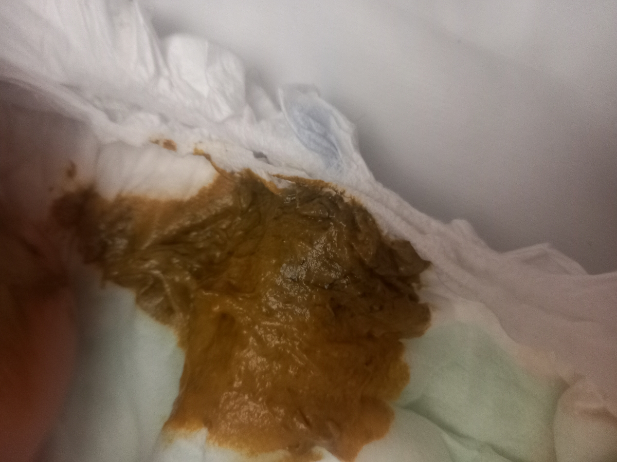 معذرت میخوام بخاطر عکس