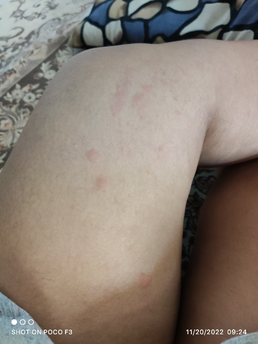 اینجوری میشه 🤕🤕🤕 کل بدنم میزنه اینجوری میشه 🤕🤕🤕 کل بدنم میزنه