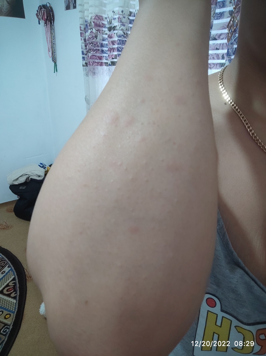 الان از دیروز اینجوری شده 🤕🤕🤕 الان از دیروز اینجوری شده 🤕🤕🤕