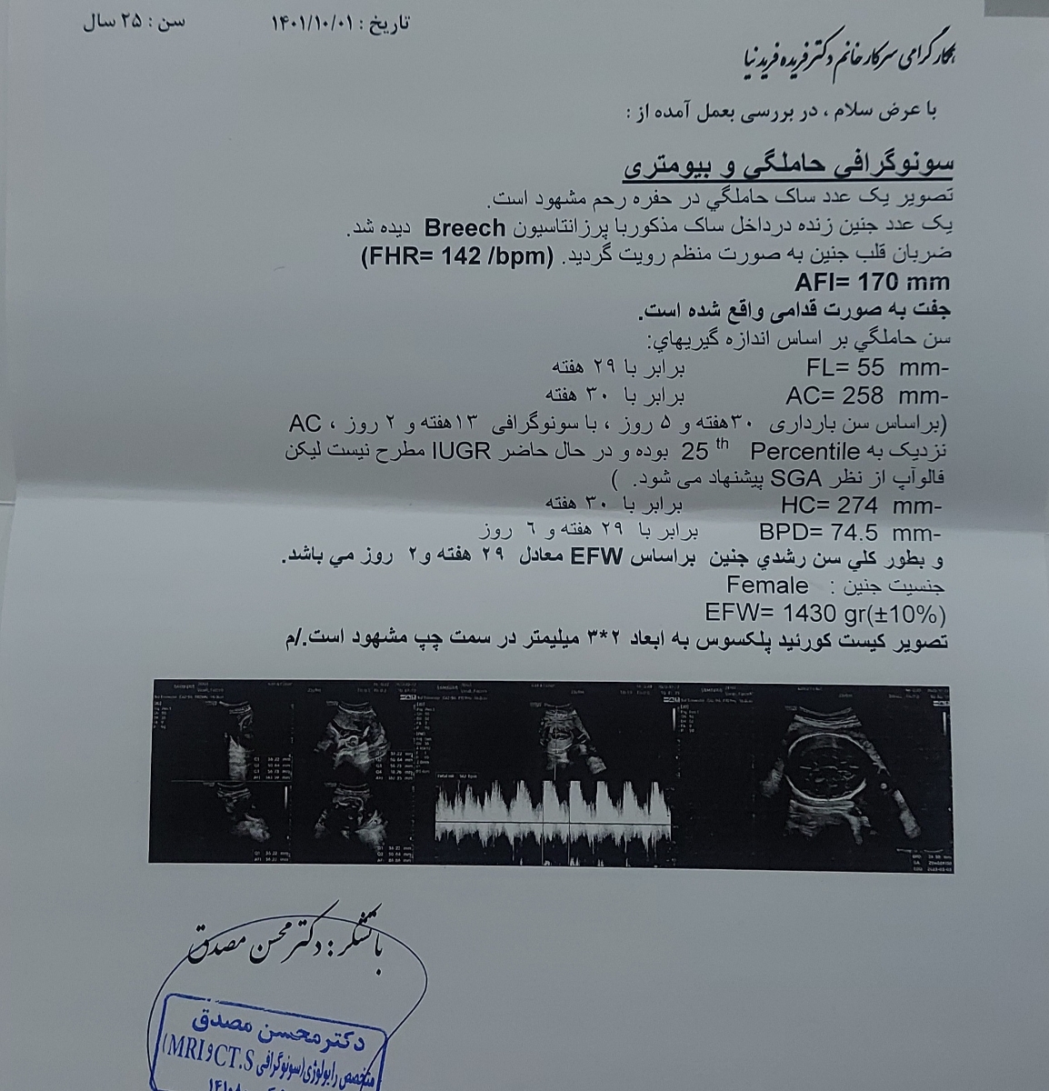 سونوگرافی ۳۰ هفته و دوروز سونوگرافی ۳۰ هفته و دوروز