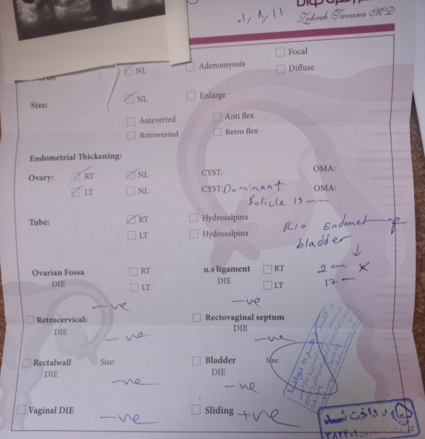 خانم دکتر تو رو خدا اگه میشه این آزمایش ها رو بررسی کنید😔 آندومتریوز مثانه خانم دکتر تو رو خدا اگه میشه این آزمایش ها رو بررسی کنید😔 آندومتریوز مثانه