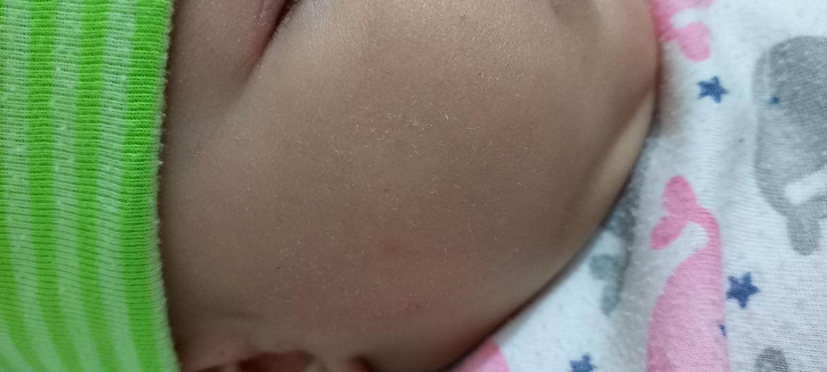 زبری و خشک بودن پوست صورت نوزاد زبری و خشک بودن پوست صورت نوزاد