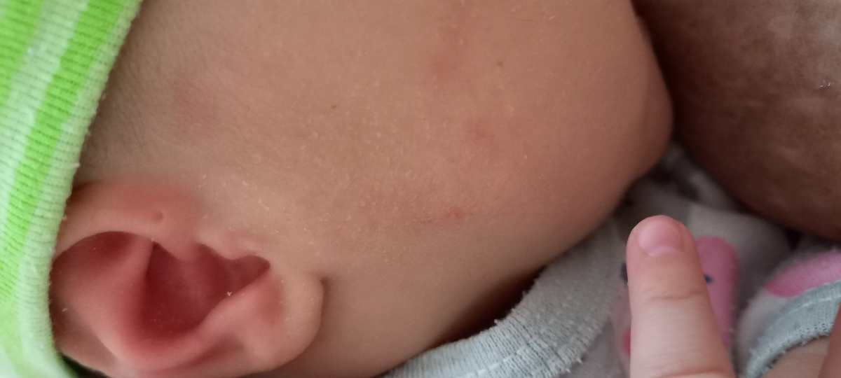 زبری و خشک بودن پوست صورت نوزاد زبری و خشک بودن پوست صورت نوزاد