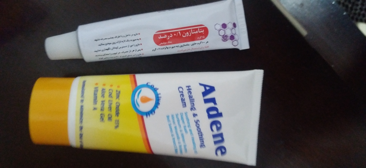 زخم مقعد نوزاد دو ماهه زخم مقعد نوزاد دو ماهه
