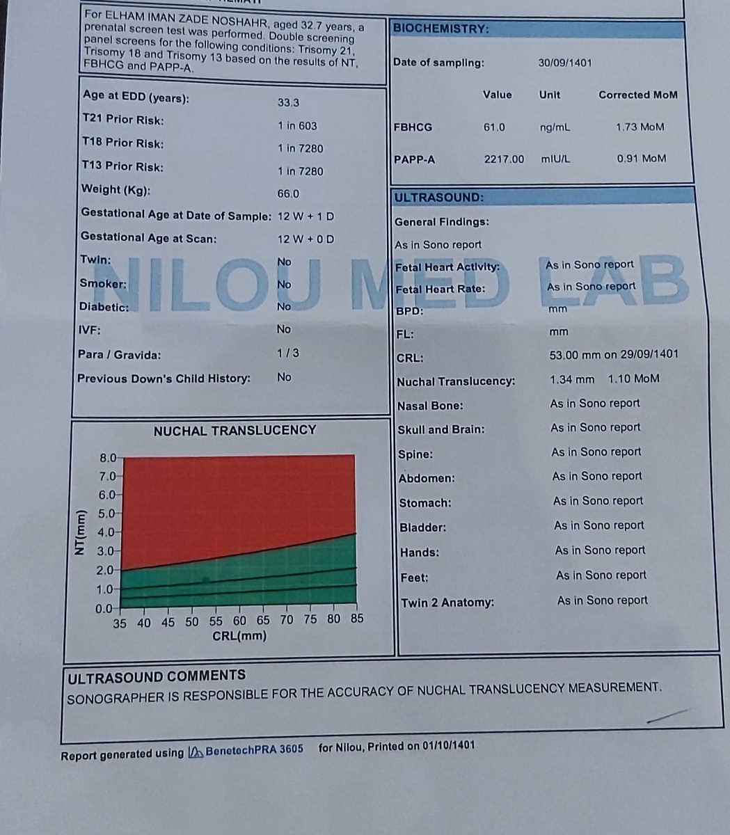 ریسک یا عدم ریسک در آزمایش ان تی ریسک یا عدم ریسک در آزمایش ان تی