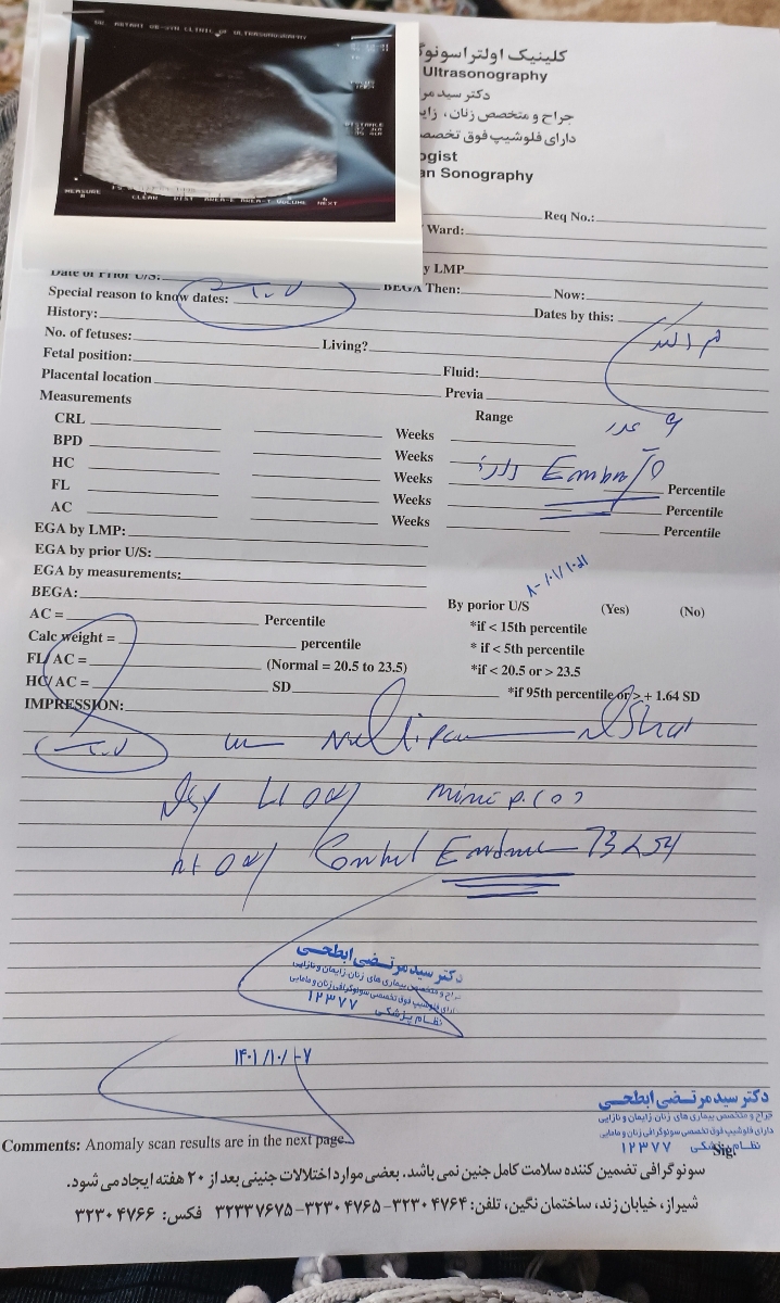 تفسیر سونوی تخمدان و کیست