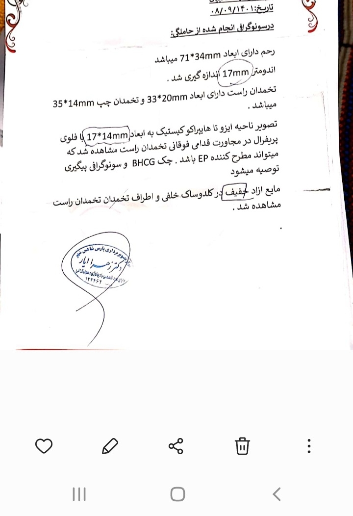 مقدار بتا بعد از لاپاراسکوپی خارج رحمی